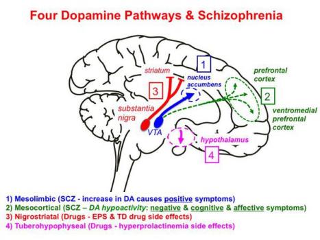 Шизофрения: симптомы и признаки